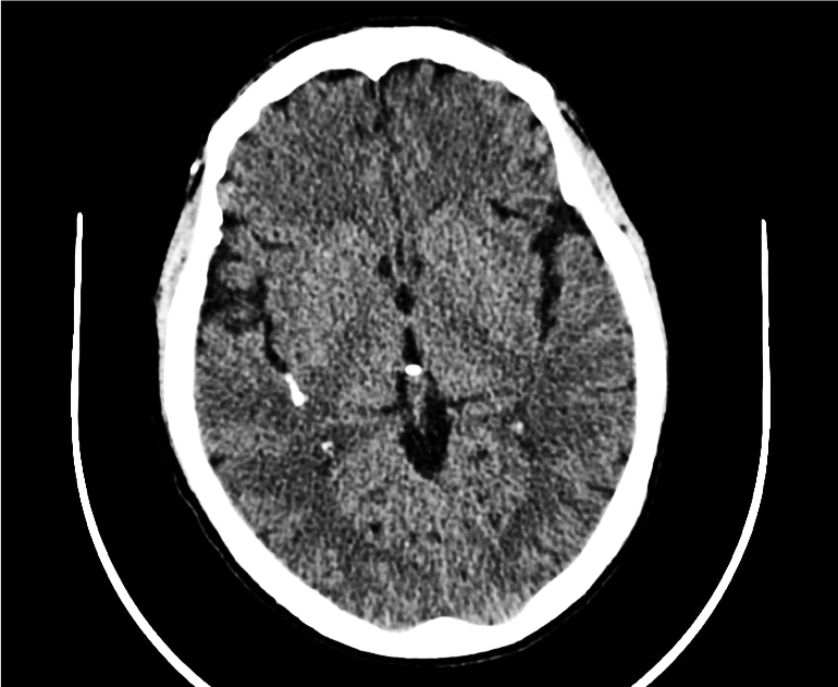 Description: Imagen en blanco y negro  Descripción generada automáticamente con confianza media